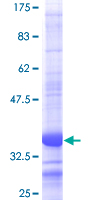 PFKM / PFK-1 Protein - 12.5% SDS-PAGE Stained with Coomassie Blue