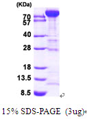 PFKM / PFK-1 Protein