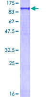 PFKP Protein - 12.5% SDS-PAGE of human PFKP stained with Coomassie Blue