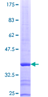 PFKP Protein - 12.5% SDS-PAGE Stained with Coomassie Blue.