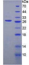PFKP Protein - Recombinant Phosphofructokinase, Platelet By SDS-PAGE