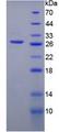 PFKP Protein - Recombinant Phosphofructokinase, Platelet By SDS-PAGE