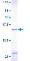 PFN1 / Profilin 1 Protein - 12.5% SDS-PAGE of human PFN1 stained with Coomassie Blue