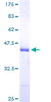 PFN1 / Profilin 1 Protein - 12.5% SDS-PAGE of human PFN1 stained with Coomassie Blue