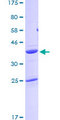 PFN2 / Profilin 2 Protein - 12.5% SDS-PAGE of human PFN2 stained with Coomassie Blue