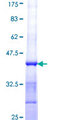 PFN2 / Profilin 2 Protein - 12.5% SDS-PAGE Stained with Coomassie Blue.