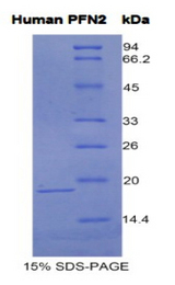 PFN2 / Profilin 2 Protein - Recombinant Profilin 2 By SDS-PAGE