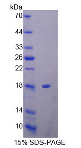 PFN3 Protein - Recombinant  Profilin 3 By SDS-PAGE