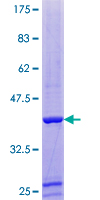 PFN4 Protein - 12.5% SDS-PAGE of human PFN4 stained with Coomassie Blue