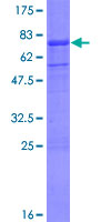 PGA5 / Pepsin A Protein - 12.5% SDS-PAGE of human PGA5 stained with Coomassie Blue