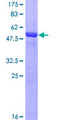 PGAM1 Protein - 12.5% SDS-PAGE of human PGAM1 stained with Coomassie Blue