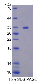 PGAM1 Protein - Recombinant Phosphoglycerate Mutase 1, Brain By SDS-PAGE