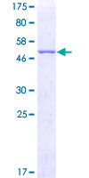 PGAM2 Protein - 12.5% SDS-PAGE of human PGAM2 stained with Coomassie Blue