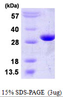 PGAM2 Protein