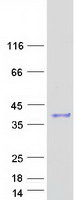 PGAM5 Protein - Purified recombinant protein PGAM5 was analyzed by SDS-PAGE gel and Coomassie Blue Staining