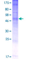 PGAP3 / PERLD1 Protein - 12.5% SDS-PAGE of human PERLD1 stained with Coomassie Blue