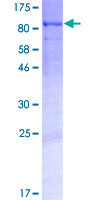 PGBD4 Protein - 12.5% SDS-PAGE of human PGBD4 stained with Coomassie Blue