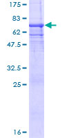 PGC / Pepsin C Protein - 12.5% SDS-PAGE of human PGC stained with Coomassie Blue