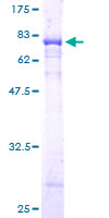 PGCP / Aminopeptidase Protein - 12.5% SDS-PAGE of human PGCP stained with Coomassie Blue