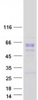 PGCP / Aminopeptidase Protein - Purified recombinant protein CPQ was analyzed by SDS-PAGE gel and Coomassie Blue Staining