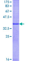 PGES / PTGES Protein - 12.5% SDS-PAGE of human PTGES stained with Coomassie Blue