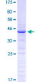 PGF / PLGF Protein - 12.5% SDS-PAGE of human PGF stained with Coomassie Blue