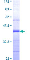 PGF / PLGF Protein - 12.5% SDS-PAGE Stained with Coomassie Blue