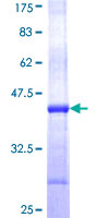 PGGT1B Protein - 12.5% SDS-PAGE Stained with Coomassie Blue
