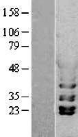PGK1 / Phosphoglycerate Kinase Protein - Western validation with an anti-DDK antibody * L: Control HEK293 lysate R: Over-expression lysate