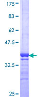 PGK1 / Phosphoglycerate Kinase Protein - 12.5% SDS-PAGE Stained with Coomassie Blue.