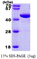 PGK1 / Phosphoglycerate Kinase Protein