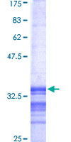 PGK2 Protein - 12.5% SDS-PAGE Stained with Coomassie Blue.