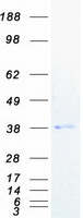 PGLYRP3 Protein - Purified recombinant protein PGLYRP3 was analyzed by SDS-PAGE gel and Coomassie Blue Staining