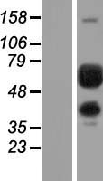 PGM1 / Phosphoglucomutase 1 Protein - Western validation with an anti-DDK antibody * L: Control HEK293 lysate R: Over-expression lysate
