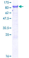 PGM2 Protein - 12.5% SDS-PAGE of human PGM2 stained with Coomassie Blue
