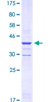 PGM2 Protein - 12.5% SDS-PAGE Stained with Coomassie Blue.