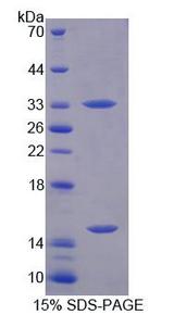 PGM3 Protein - Recombinant Phosphoglucomutase 3 (PGM3) by SDS-PAGE