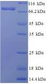 PGM3 Protein