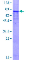 PGM5 / Aciculin Protein - 12.5% SDS-PAGE of human PGM5 stained with Coomassie Blue