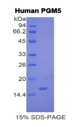 PGM5 / Aciculin Protein - Recombinant Phosphoglucomutase 5 By SDS-PAGE