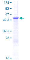 PGRMC1 / MPR Protein - 12.5% SDS-PAGE of human PGRMC1 stained with Coomassie Blue