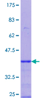 PGRMC1 / MPR Protein - 12.5% SDS-PAGE Stained with Coomassie Blue.