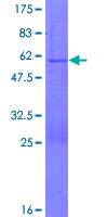 PGRMC2 Protein - 12.5% SDS-PAGE of human PGRMC2 stained with Coomassie Blue
