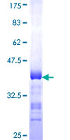 PGRMC2 Protein - 12.5% SDS-PAGE Stained with Coomassie Blue.