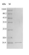 PH / PAH Protein - (Tris-Glycine gel) Discontinuous SDS-PAGE (reduced) with 5% enrichment gel and 15% separation gel.