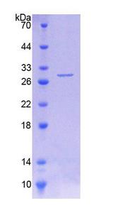 PH / PAH Protein - Recombinant Phenylalanine Hydroxylase By SDS-PAGE
