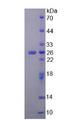 PH / PAH Protein - Recombinant Phenylalanine Hydroxylase By SDS-PAGE