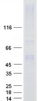 PH / PAH Protein - Purified recombinant protein PAH was analyzed by SDS-PAGE gel and Coomassie Blue Staining