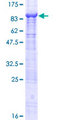 PH4 / P4HTM Protein - 12.5% SDS-PAGE of human P4HTM stained with Coomassie Blue