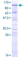 PHACTR2 Protein - 12.5% SDS-PAGE of human PHACTR2 stained with Coomassie Blue